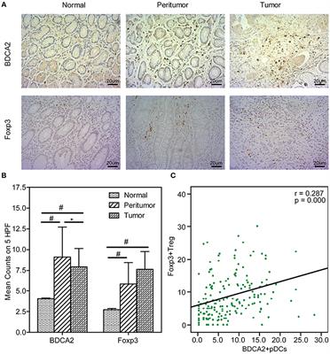 Regulatory T Cells and Plasmacytoid Dendritic Cells Within the Tumor Microenvironment in Gastric Cancer Are Correlated With Gastric Microbiota Dysbiosis: A Preliminary Study